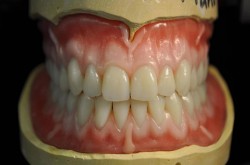 better dentures