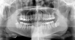 Radiografa Dental